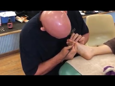 Massaging the toes using massage tools such as chopsticks and Thai massage tools part 1