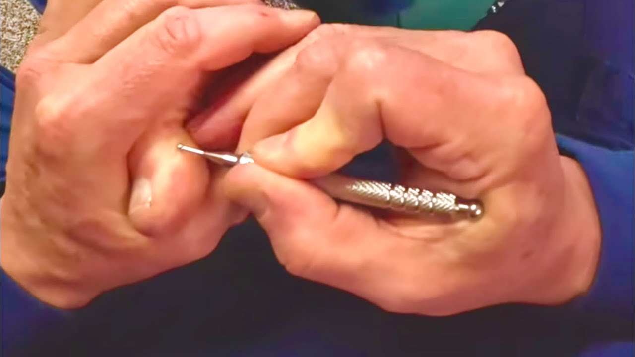 Intense big toe massage using acupressure pen. Brandon massaging Rock session 1